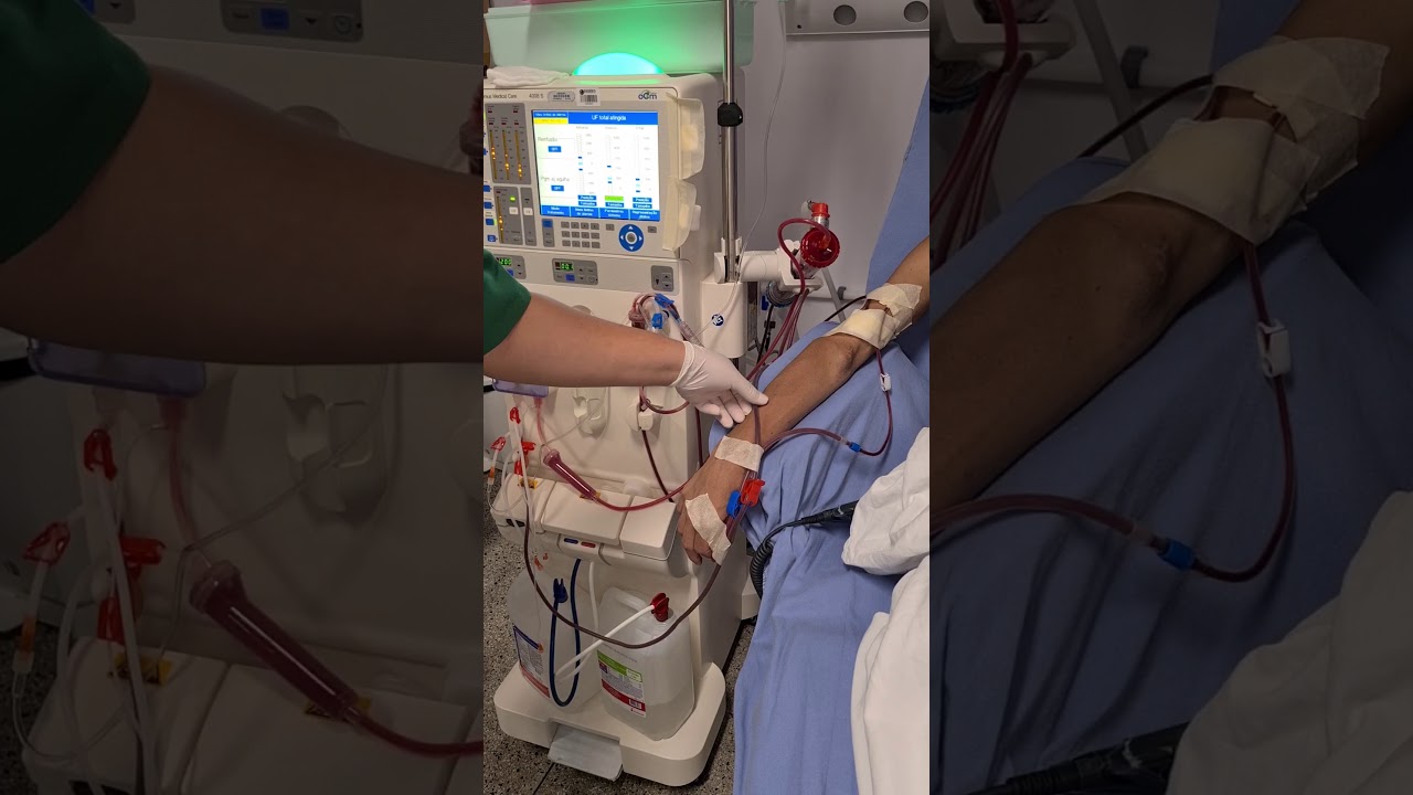 Fresenius 4008. Devolução de sangue final da HD.
