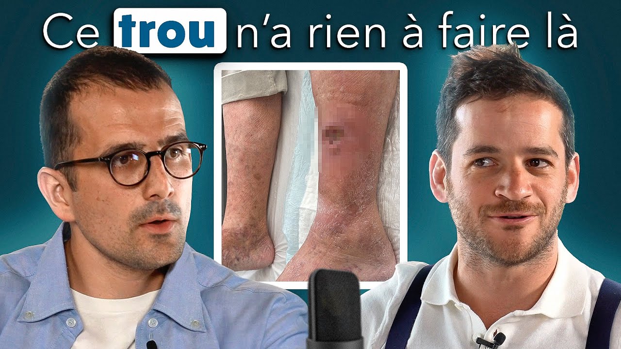 Ulcère de la peau : La Consult'