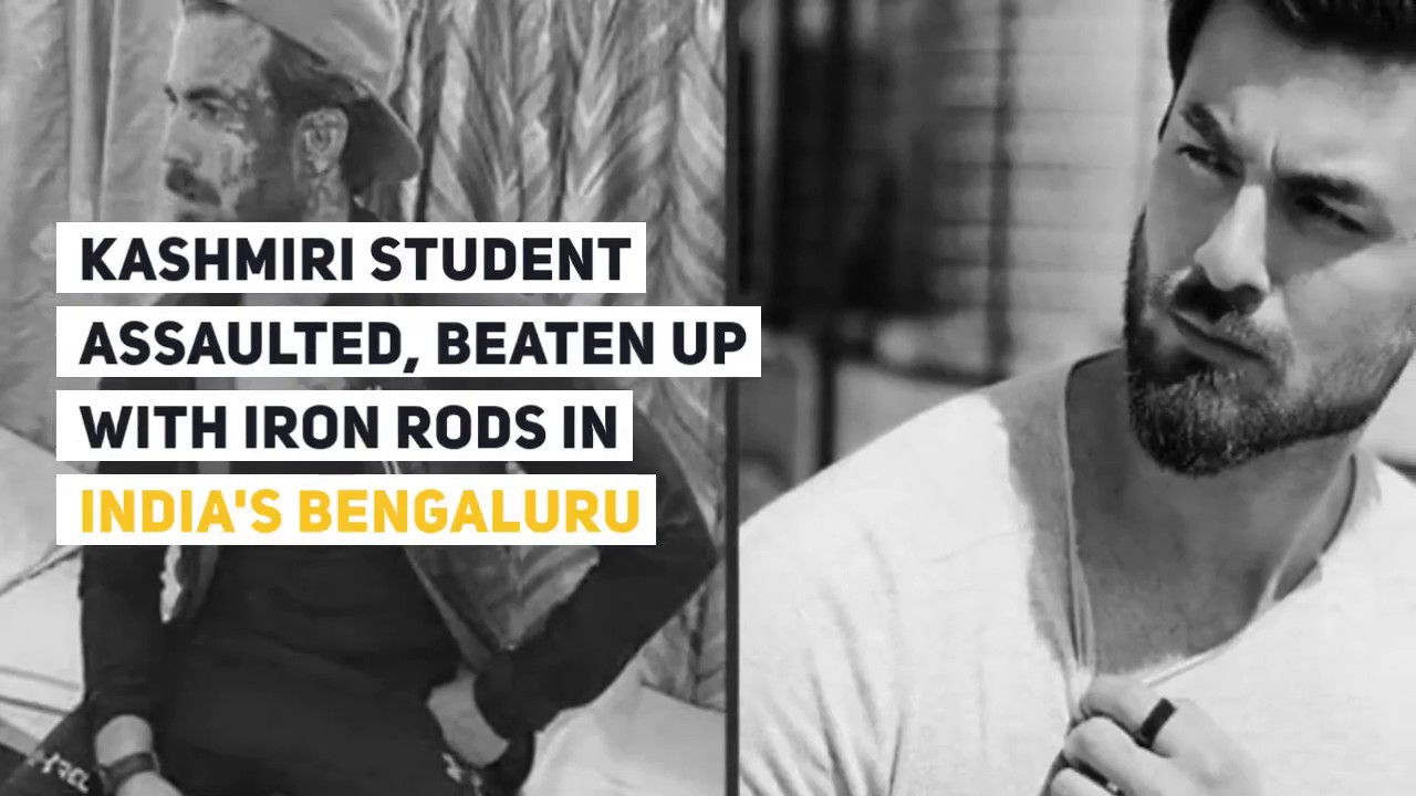 Kashmiri student assaulted beaten up with Rod - A Kashmiri Muslim beaten by Indian