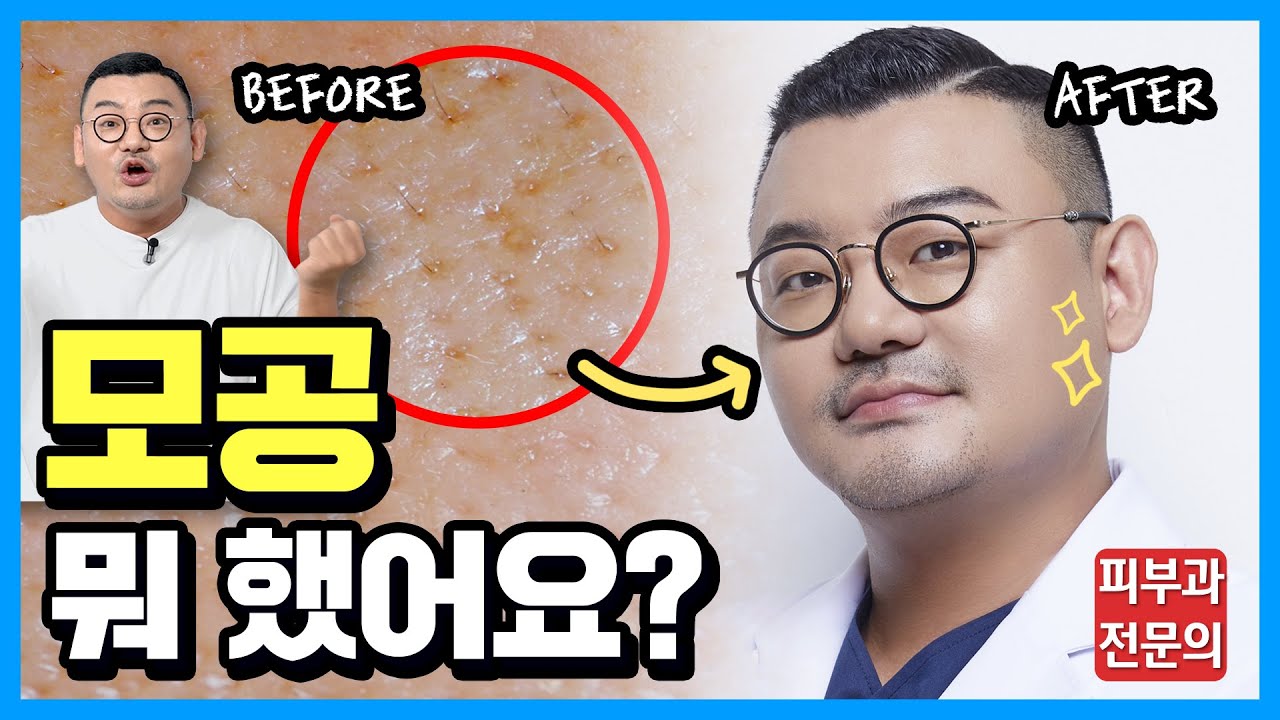 청담 피부과원장의 &lsquo;모공 줄이는 방법&rsquo; | 쫀쫀한 모공만드는 시술 총정리!