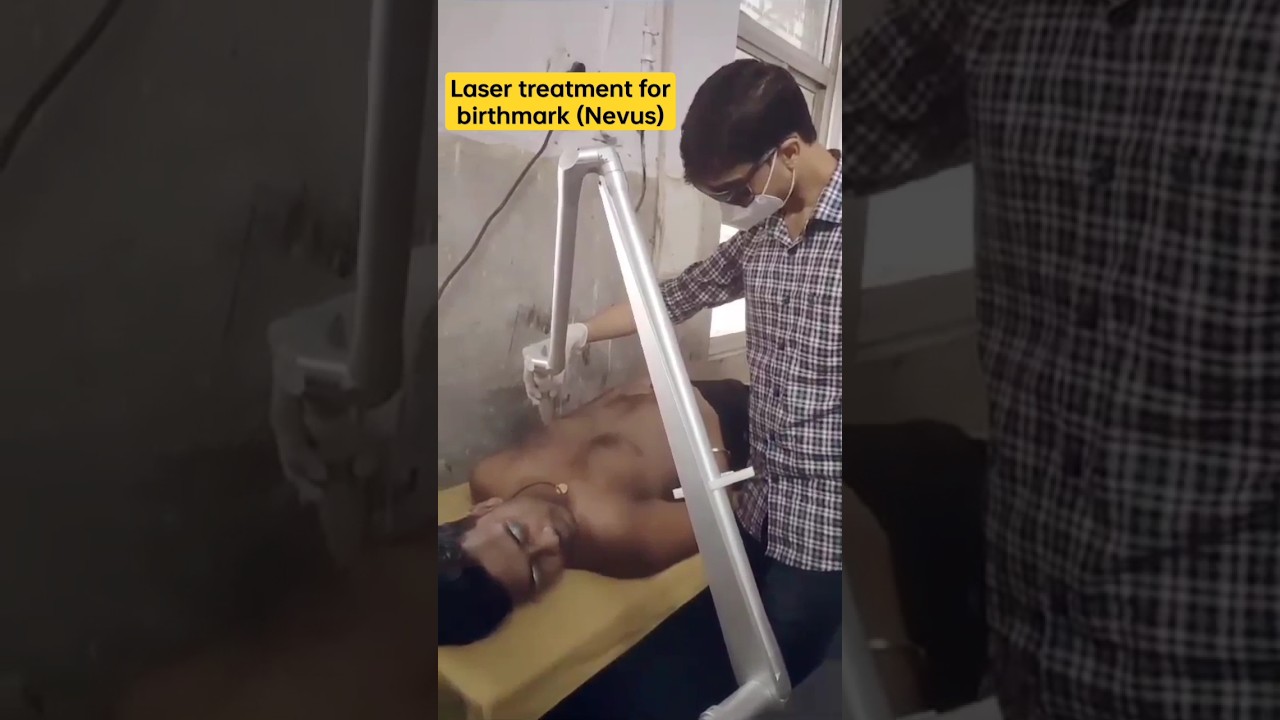#laser #birthmarkremoval #nevus #pmch  #doctor #educationalvideo  #mbbs #internship #mbbslife