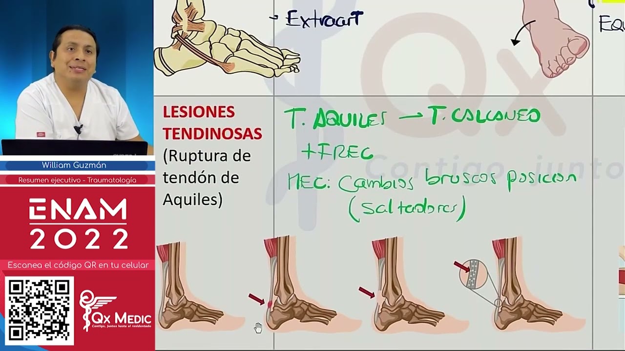 Res&uacute;menes integral - Traumatolog&iacute;a