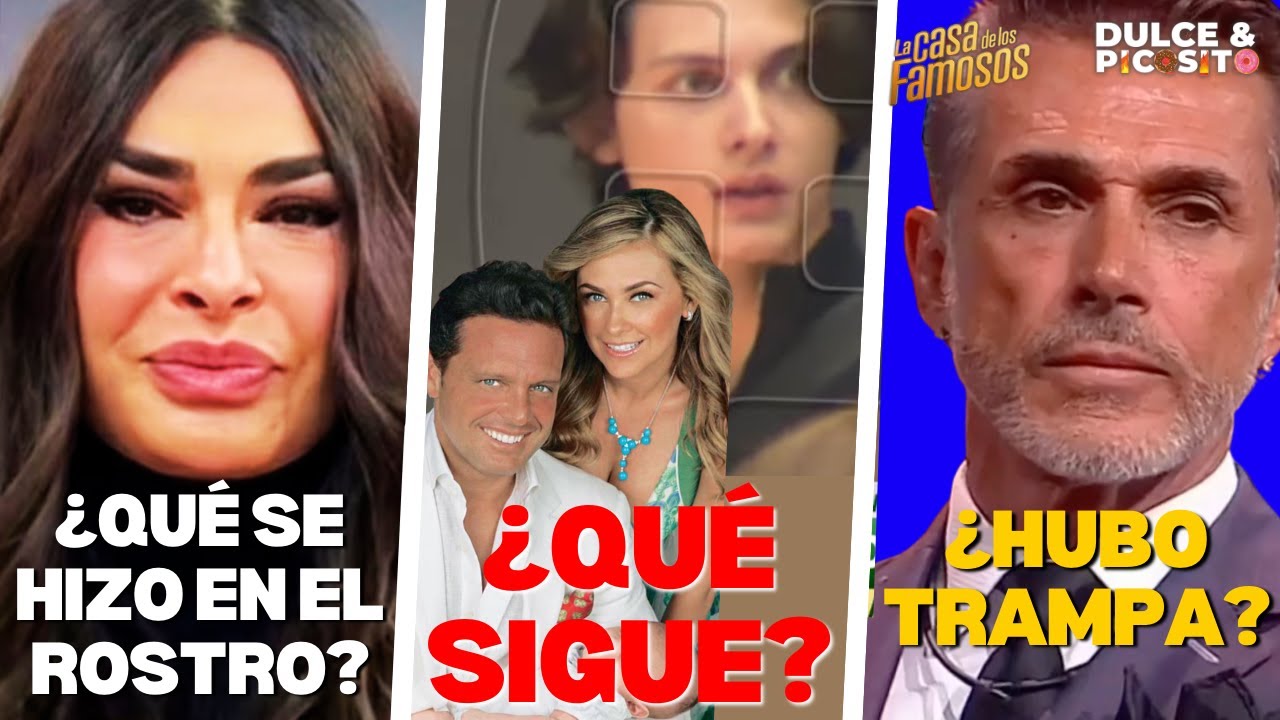 ¿GALILEA, QUÉ SE HIZO EN LA CARA?