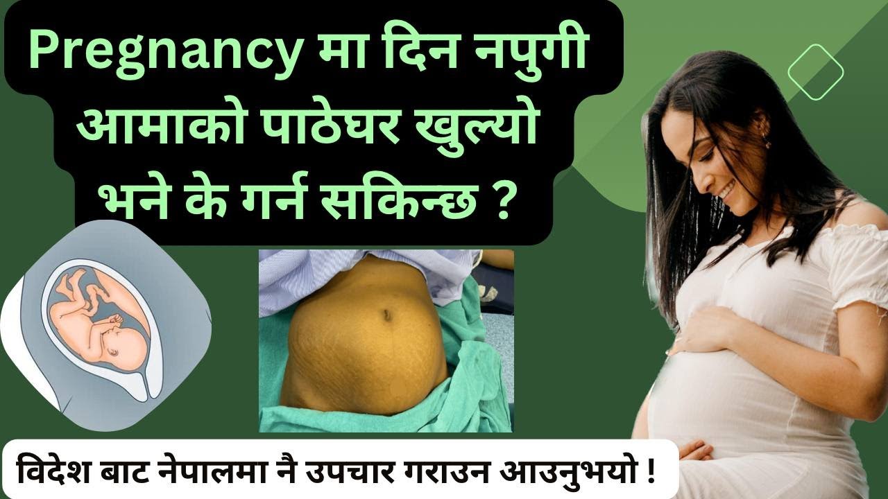 Pregnancy मा दिन नपुगी आमाको पाठेघर खुल्यो भने के गर्न सकिन्छ ? Episode 67 | Nepalese Doctor