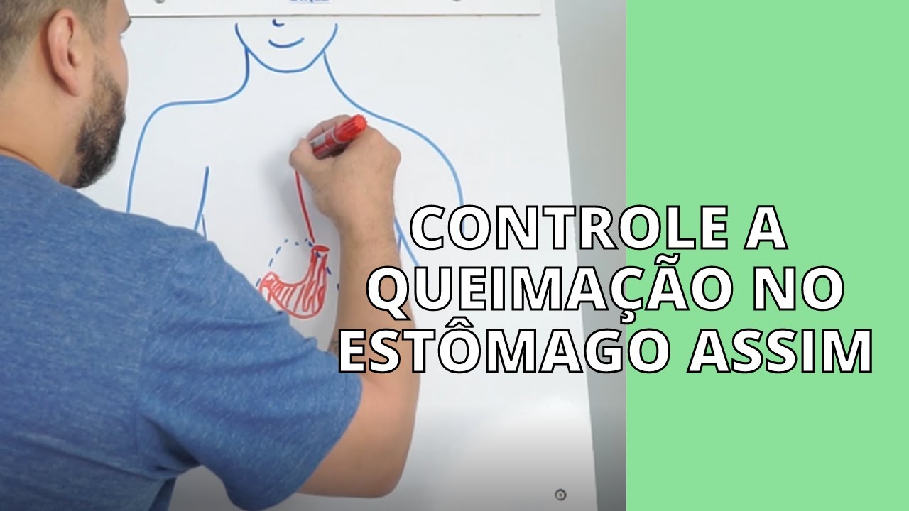 🎮 Controle a sensa&ccedil;&atilde;o de queima&ccedil;&atilde;o no est&ocirc;mago de forma 100% natural.
