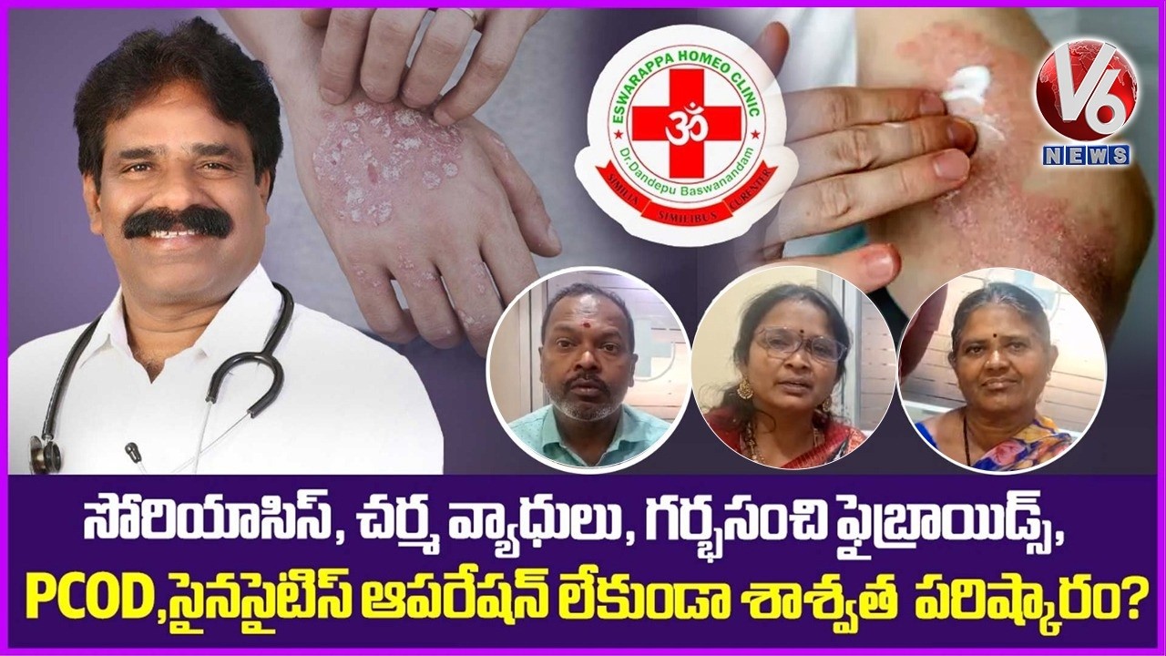 Eshwarappa Homeo Clinic - All Type Of Diseases Will Be Cured | Dandepu Baswanandam | V6 News