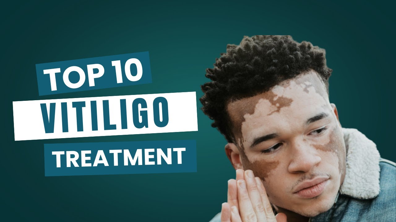 Vitiligo | Symptoms | Causes | Where it appears | Latest treatments | Phototherapy