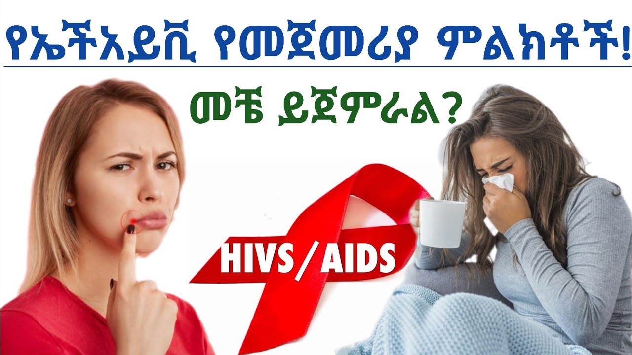 የኤች አይቪ ኤድስ የመጀመሪያ ዋና ዋና ምልክቶች|ምልክቶቹ መቼ ይጀምራል| Early sign of HIV VIRUS infections