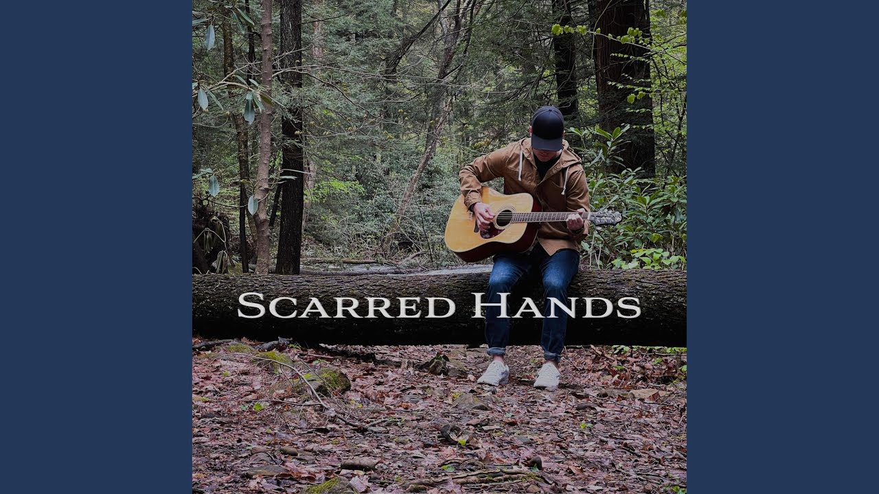 Scarred Hands