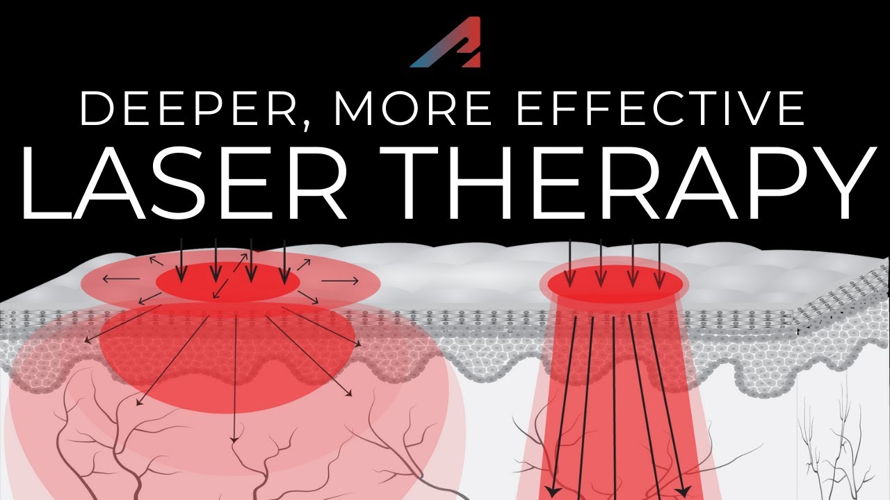 Lucium Topical Laser Therapy Demonstration