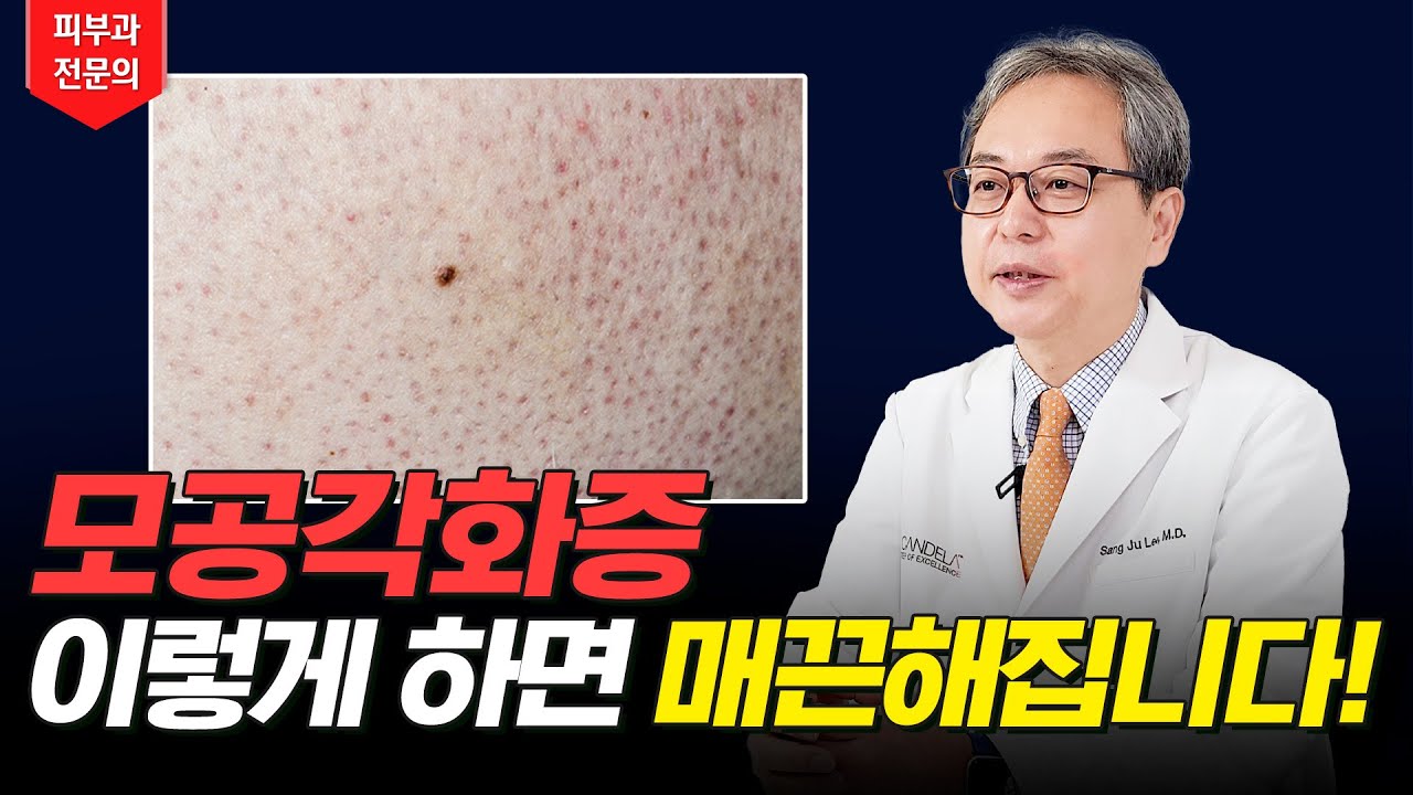 모공각화증 닭살 매끈하게 없애는 법✨