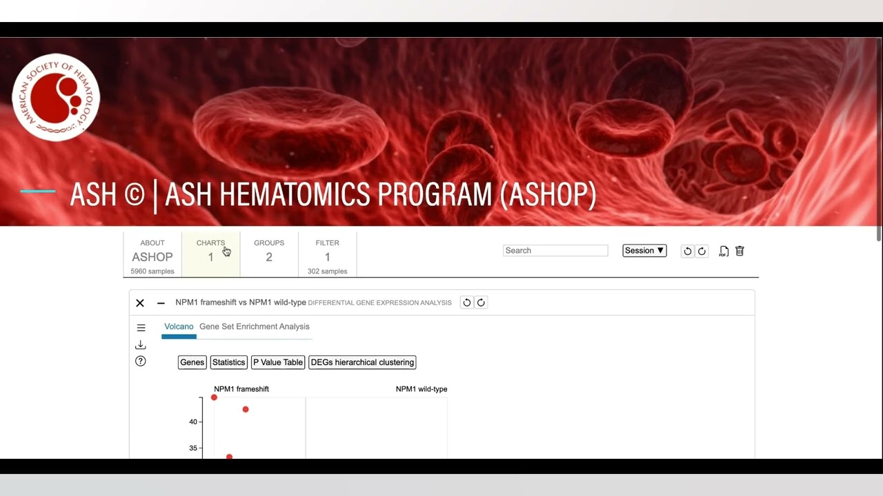ASHOP: Investigation of NPM1-mutated AML and HOX gene expression subgroups