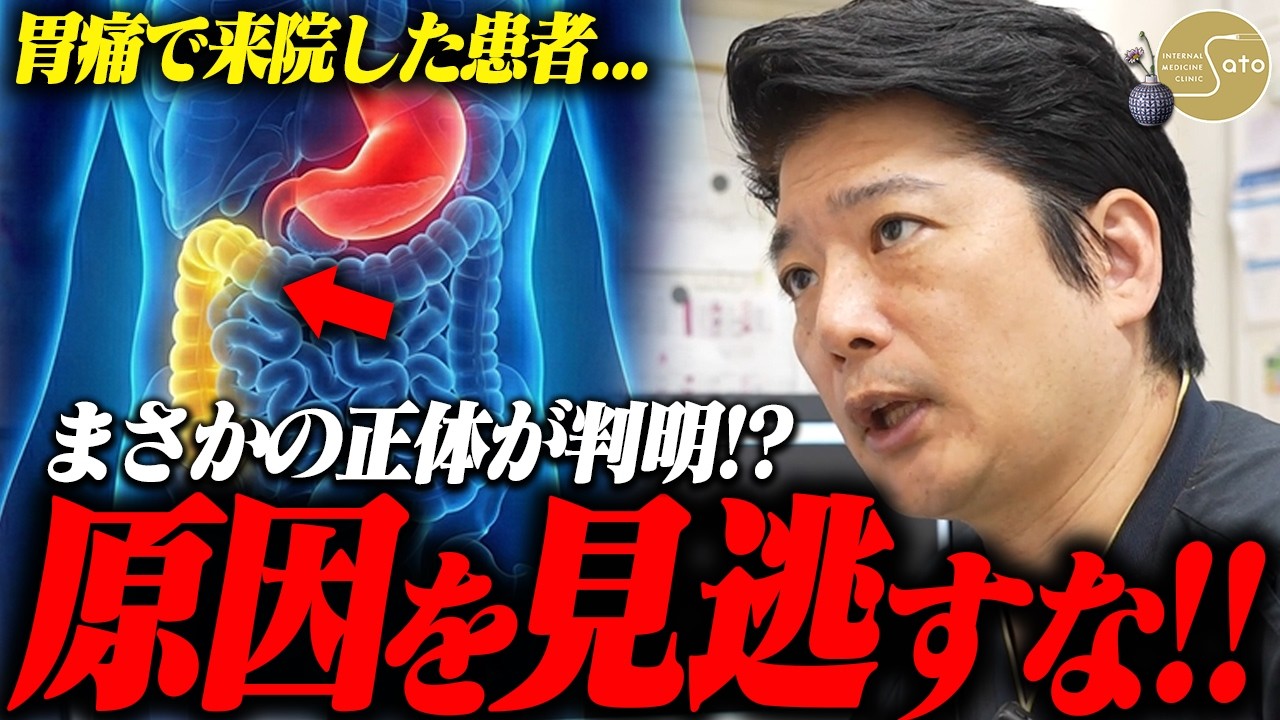 『痛みの原因はそこじゃない！』重度の胃痛を訴える患者... 医師が検査し判明した原因はまさかの箇所！？
