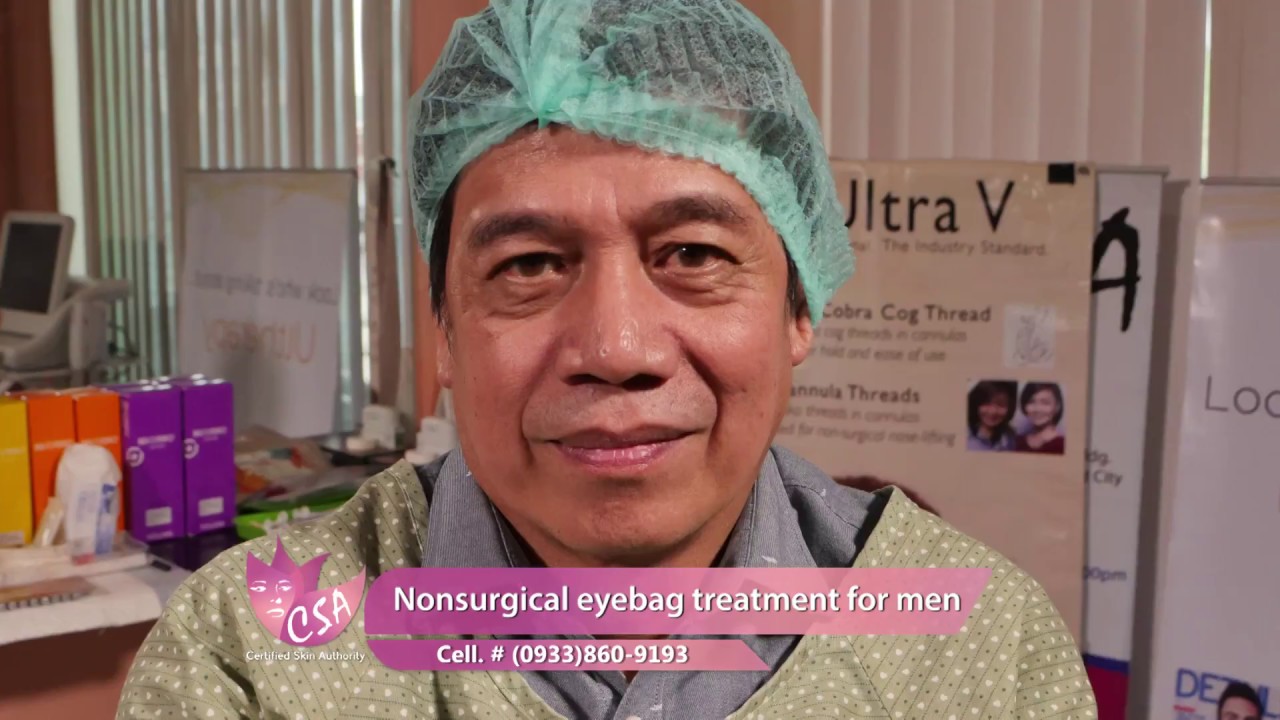Nonsurgical eyebag treatment for men