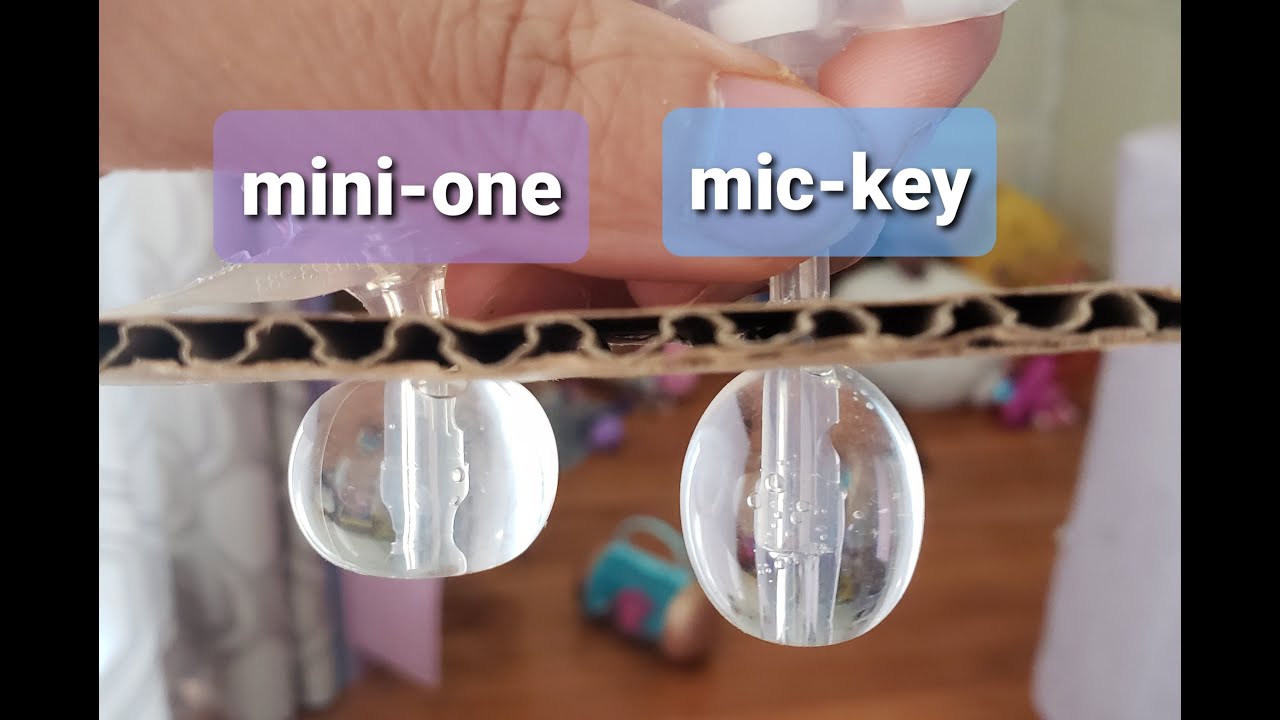 Tubie2go - Mini-One vs Mic-Key G-tube Button Comparison