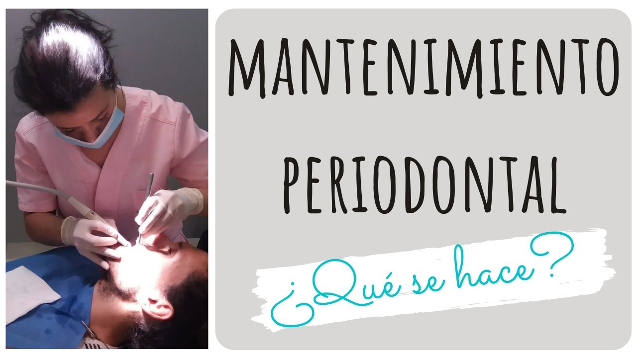 ▶MANTENIMIENTO PERIODONTAL◀ ¿Qué es? ¿Qué se hace?