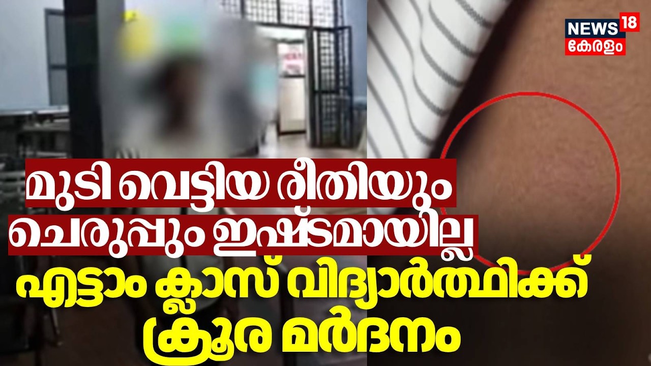 Kozhikkode  കുന്ദമംഗലത്ത് റാഗിങ്ങിനെ തുടർന്ന് എട്ടാം ക്ലാസ് വിദ്യാർത്ഥിക്ക് ക്രൂര  മർദനം | Ragging
