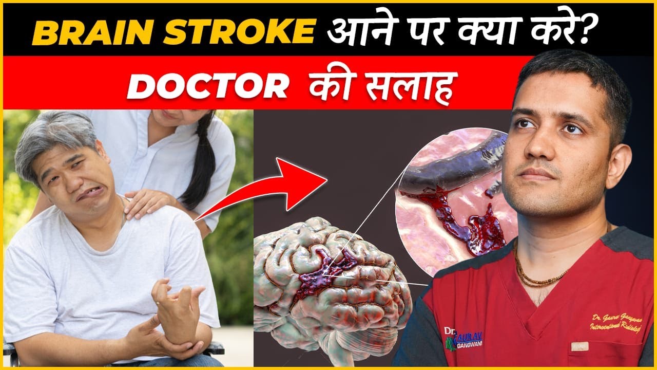 Ischemic Brain Stroke - no one may tell you this | Decision during emergency paralysis | Dr. Gaurav.