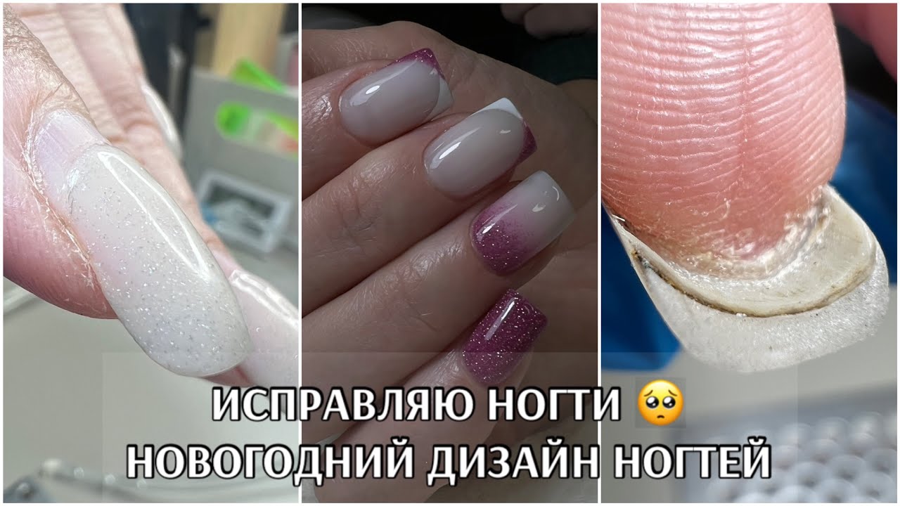 ИСПРАВЛЯЮ ногти🥺ПРОСТОЙ дизайн ногтей на Новый год 🎄 работа на клиентке❤️ УКРЕПЛЕНИЕ КВАДРАТОВ