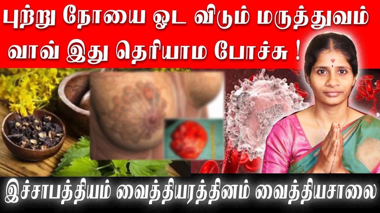 புற்று நோயை ஓட விடும் மருத்துவம் வாவ் இது தெரியாம போச்சு !இச்சாபத்தியம் வைத்தியரத்தினம் வைத்தியசாலை