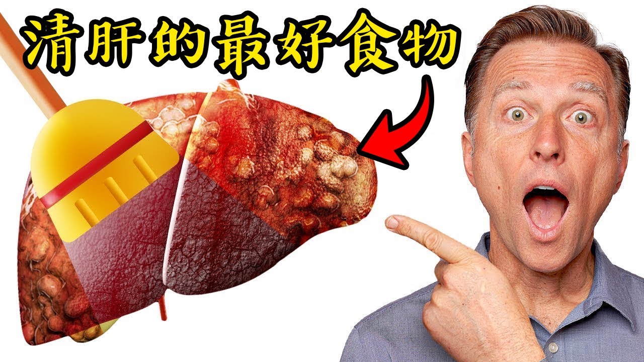 清肝、 保護肝的最佳6類食物，自然療法,柏格醫生 Dr Berg