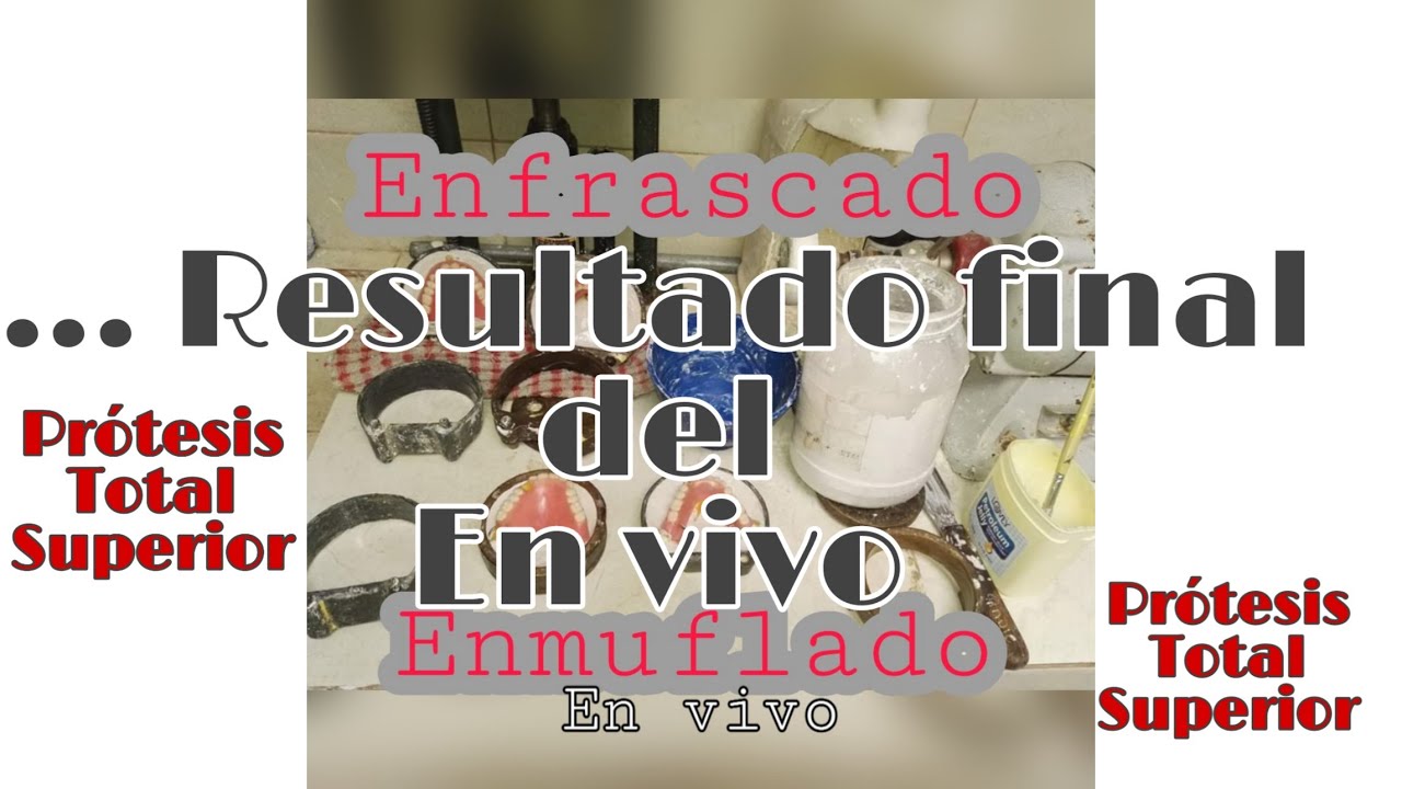 Prótesis total superior CONTINUACIÓN DEL ENFRASCADO en vivo