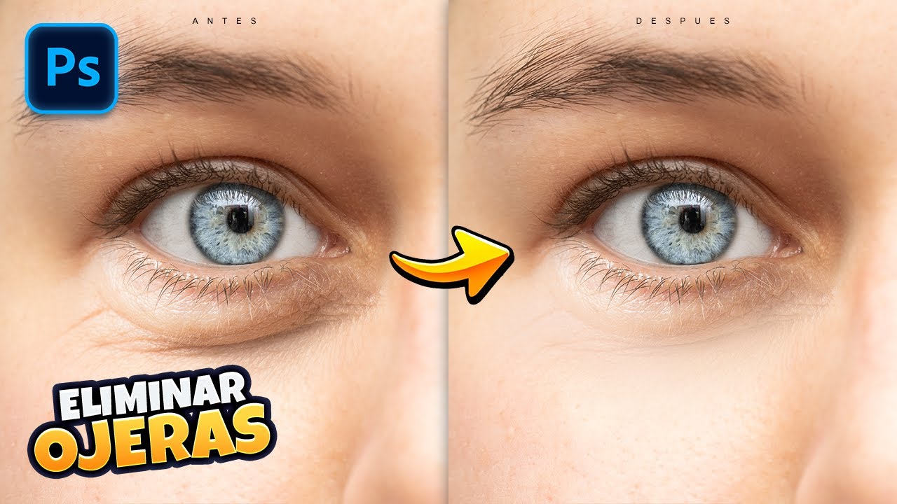 Como Quitar Ojeras y Manchas en Adobe Photoshop