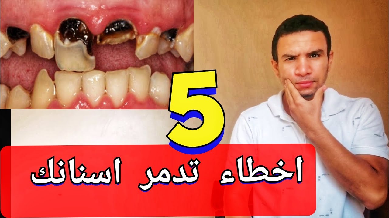 اخطاء تفعلها يوميا تدمر لثتك و اسنانك اكتشفها قبل ان يتأخر الامر