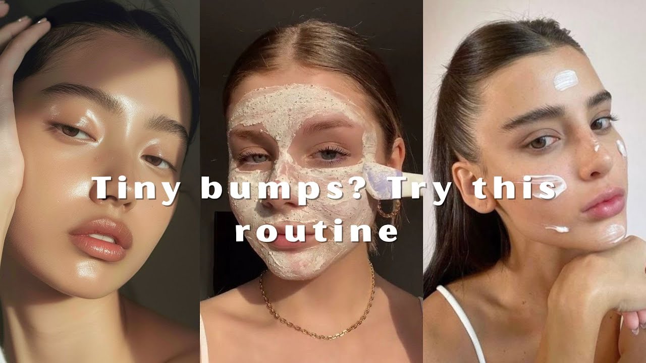 Tiny Bumps on Your Face? It&rsquo;s Not Acne &mdash; Here&rsquo;s What to Do 💧