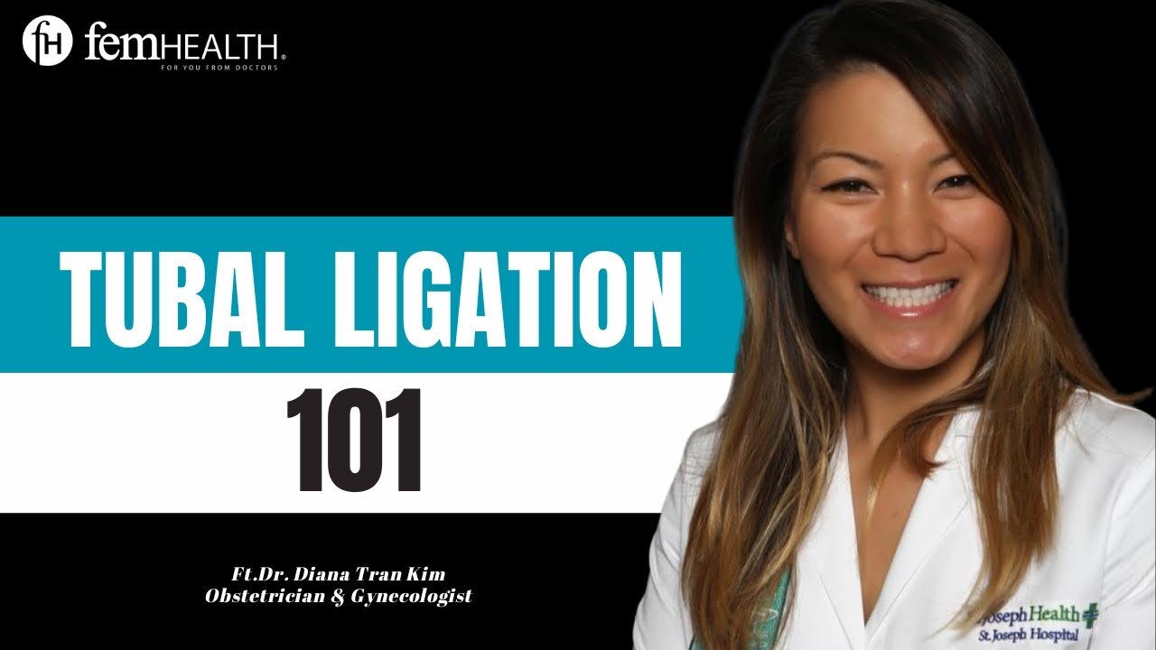 Tubal Ligation Explained: What Every Woman Should Know