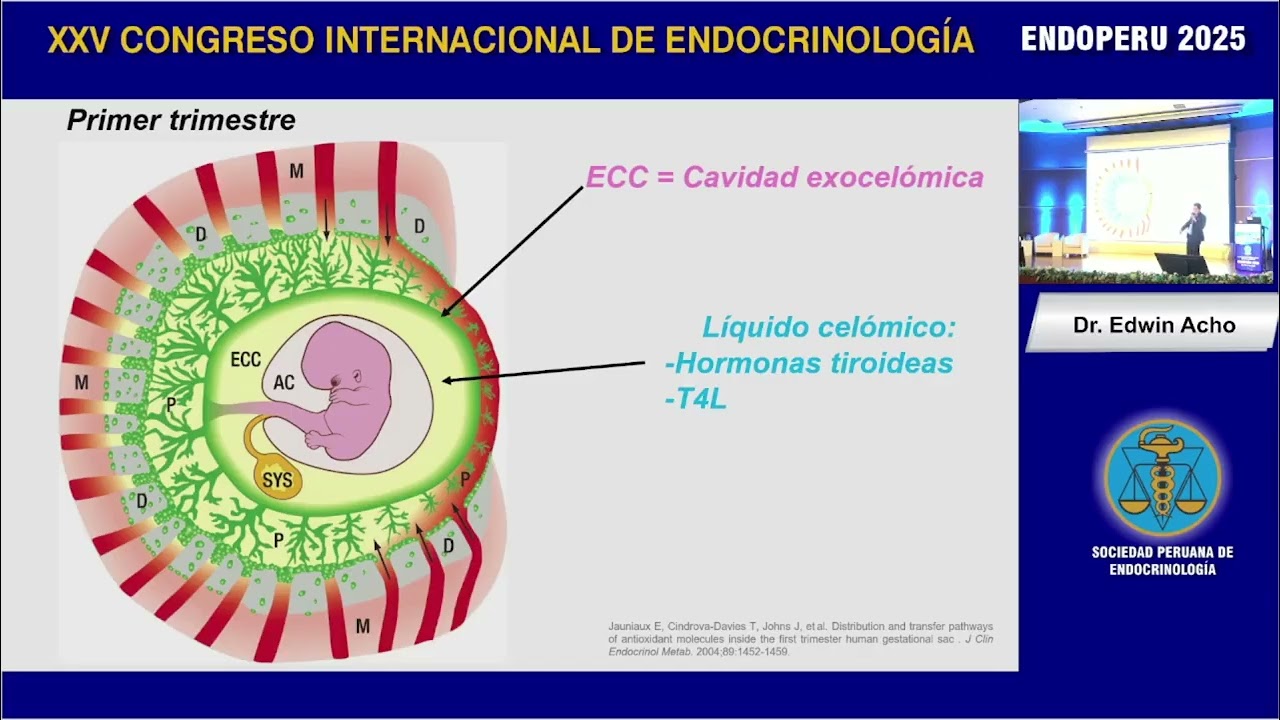SÁBADO - 8 Dr. Edwin Acho | Diversidad de la Patología Tiroidea en el Binomio Materno-Fetal.