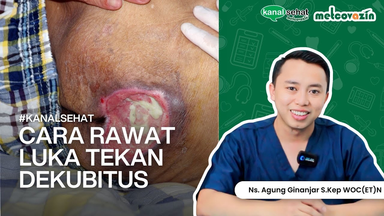 [TUTORIAL] Gimana Cara Mudah Rawat Luka Tekan Dekubitus? | Kanal Sehat by Metcovazin
