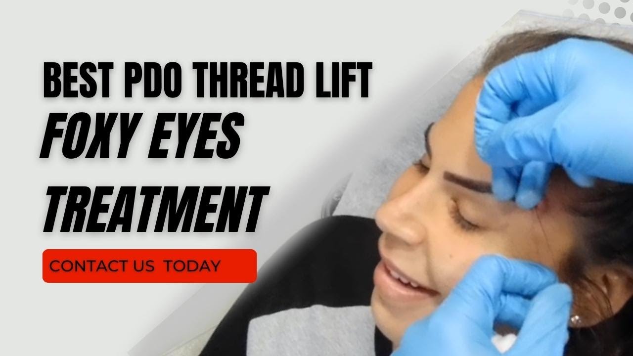 Foxy Eyes Thread Lift in West Palm Beach | Best PDO Thread Lift in West Palm Beach Gardens, Florida