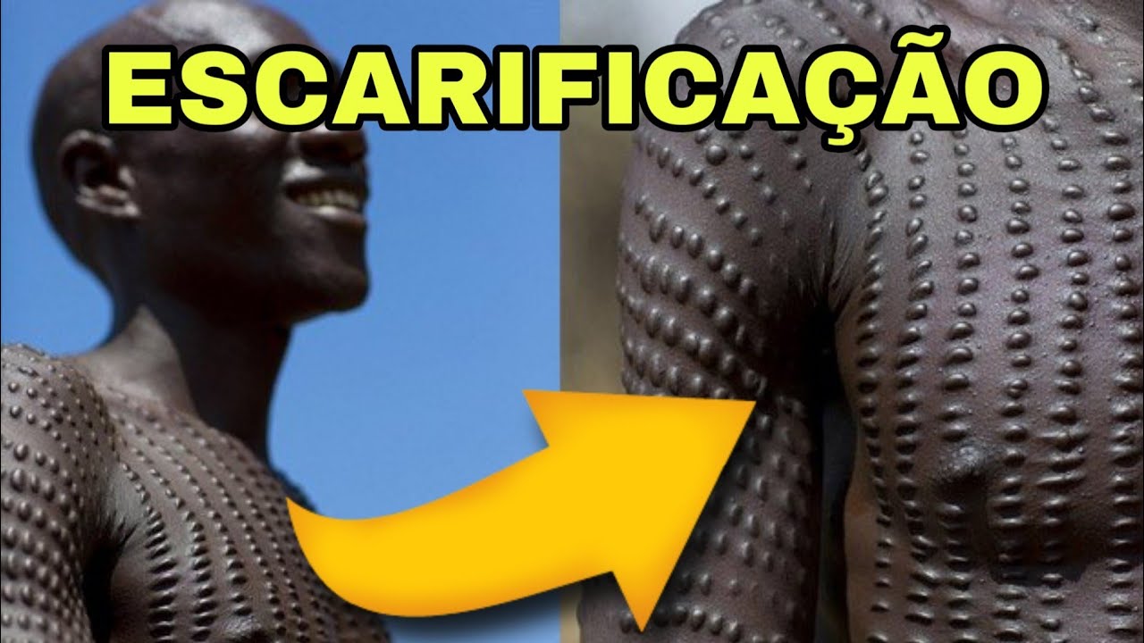 ESCARIFICAÇÃO NA ÁFRICA
