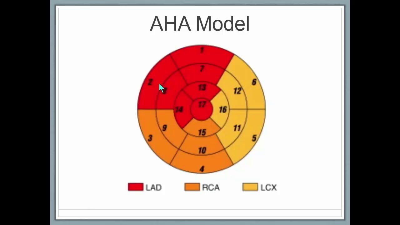 ISMRM MR Academy - Clinical Needs: Ischemic Cardiomyopathy