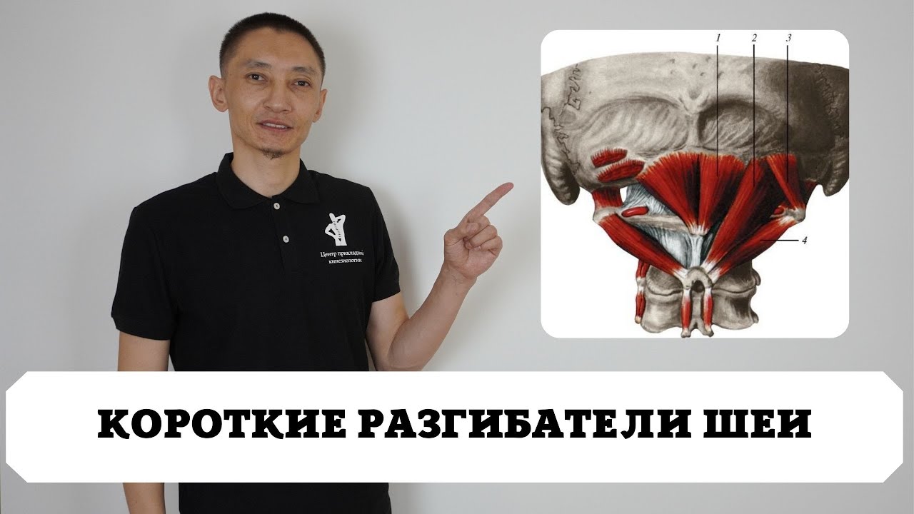 Короткие разгибатели шеи. Боль в шее. Самолечение. Кинезиология