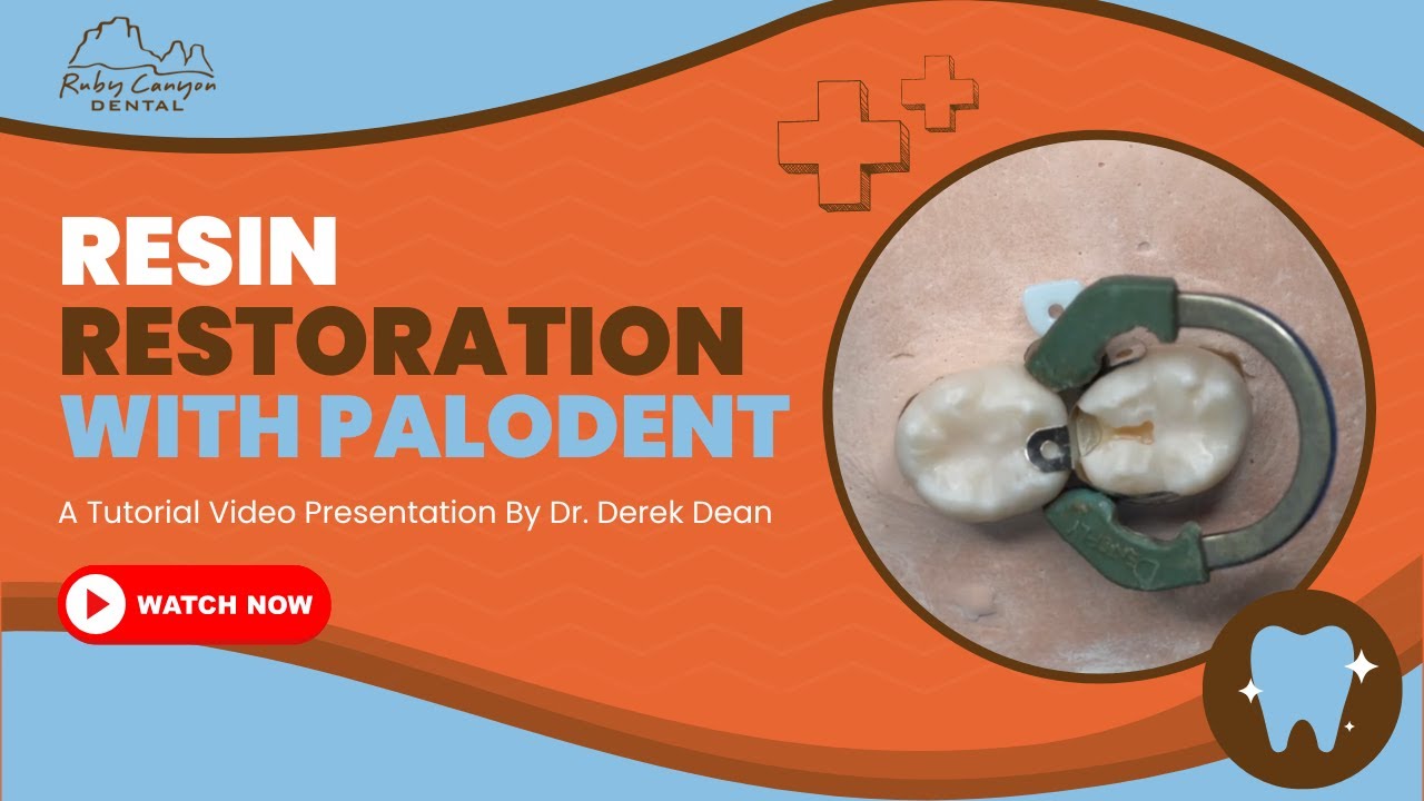 How To Do A Resin Restoration with Palodent and Sonicfill