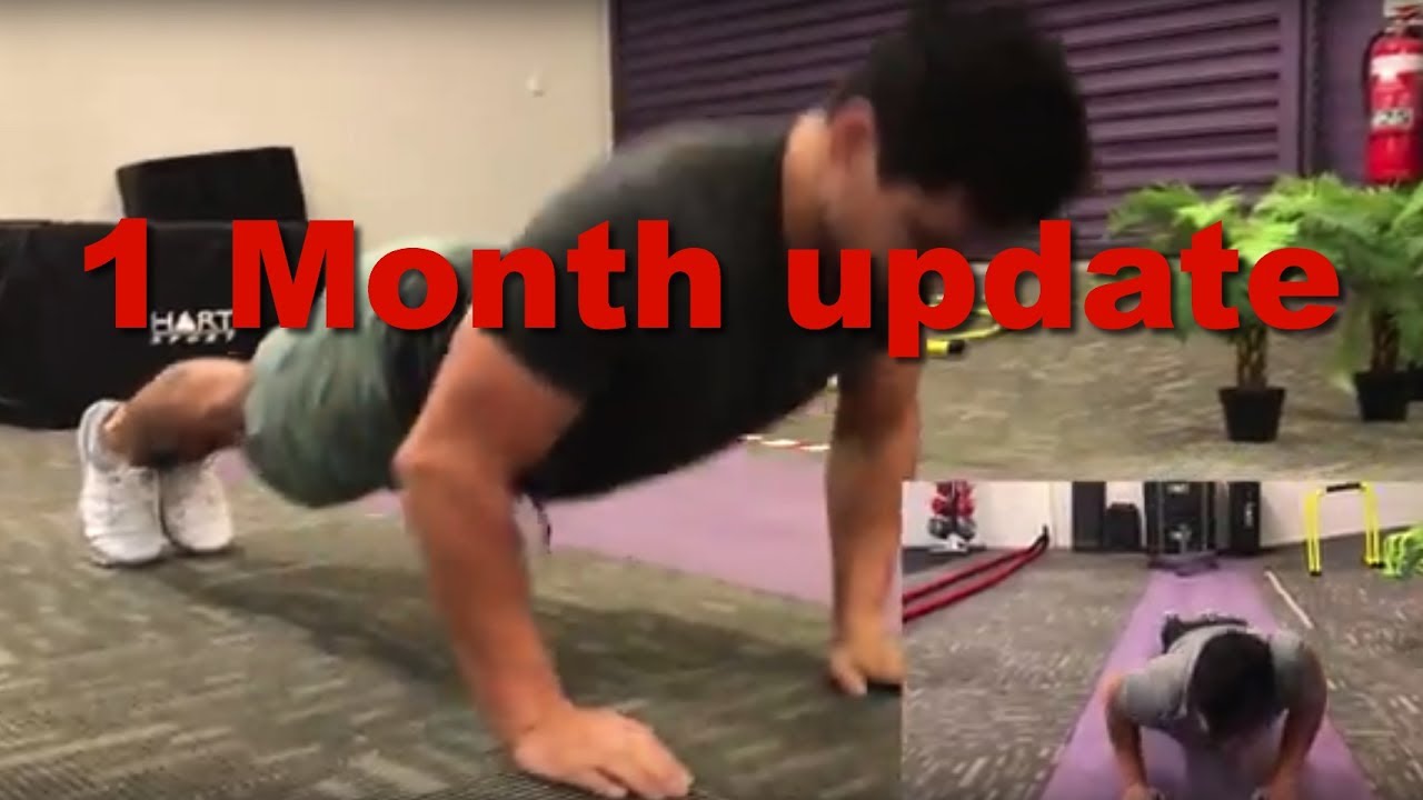 Brachial Neuritis, Parsonage Turner: 1 Month progress update