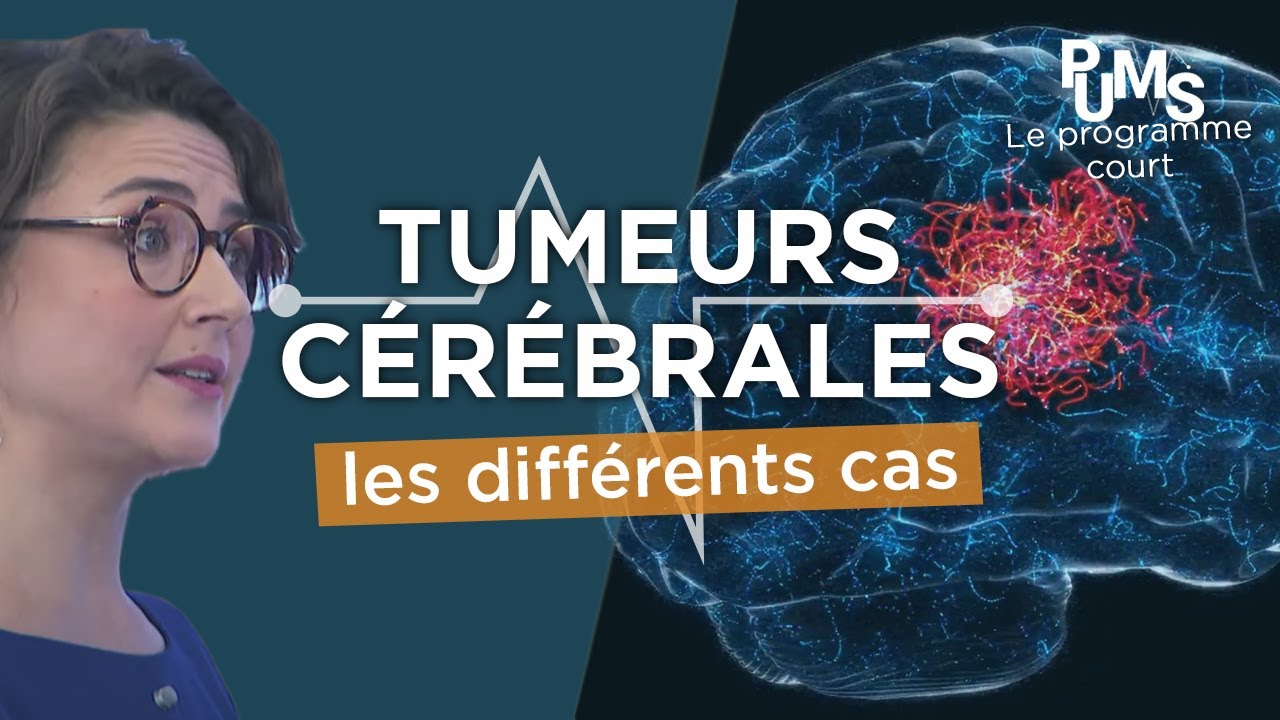 Est-ce qu’une tumeur au cerveau est grave ? Les différentes tumeurs cérébrales.