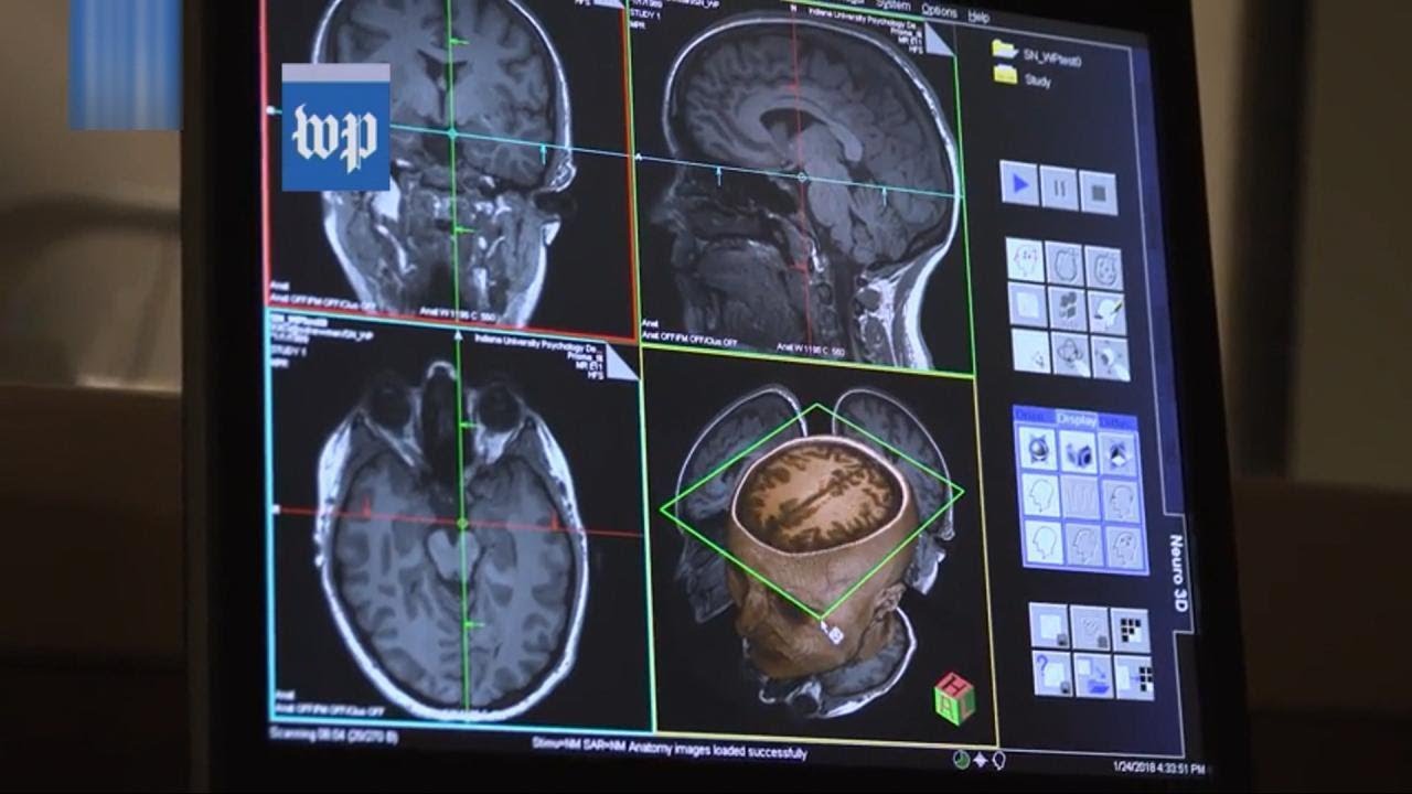 Is Reality TV Negatively Affecting Your Brain?
