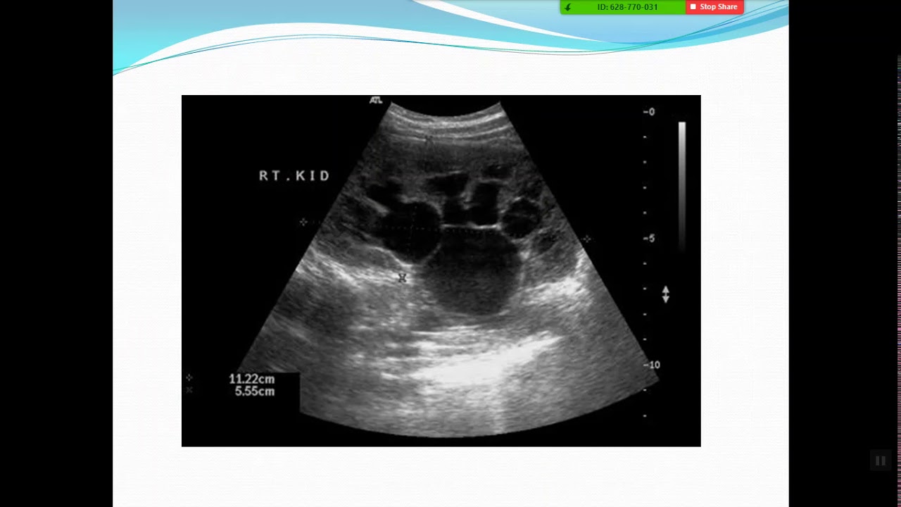 Imaging of the pediatric genitourinary system