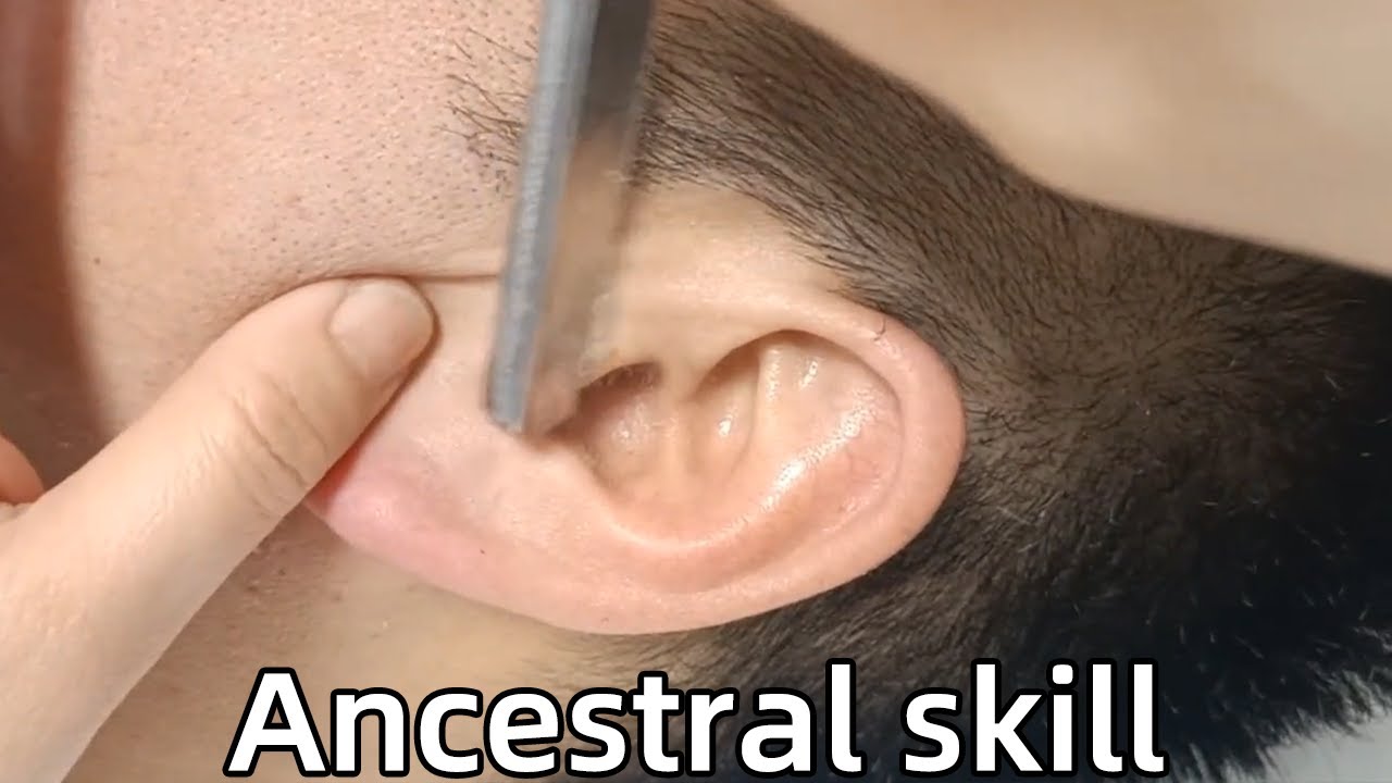 💈ASMR Rare Razor Shave|Carry forward ancestral skills, Shave the hair on ears clean！relieve stress