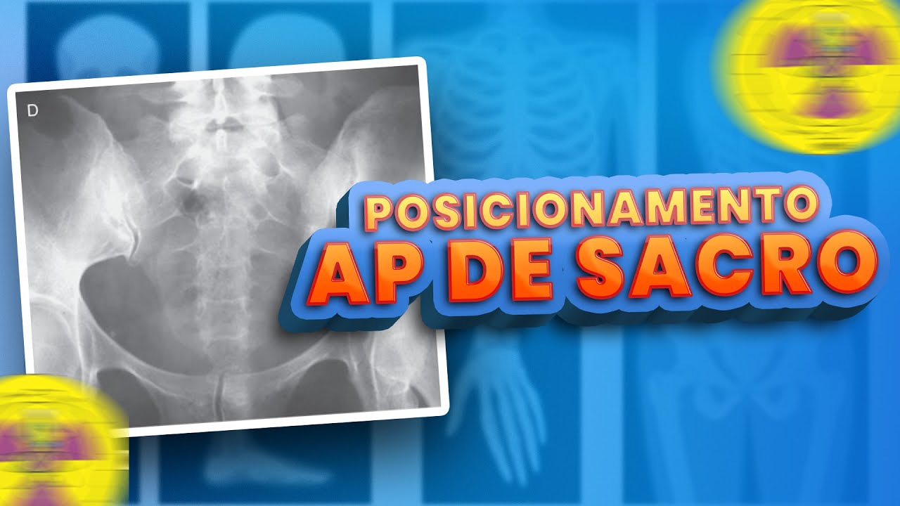 POSICIONAMENTO - AP DE SACRO | Radiologando