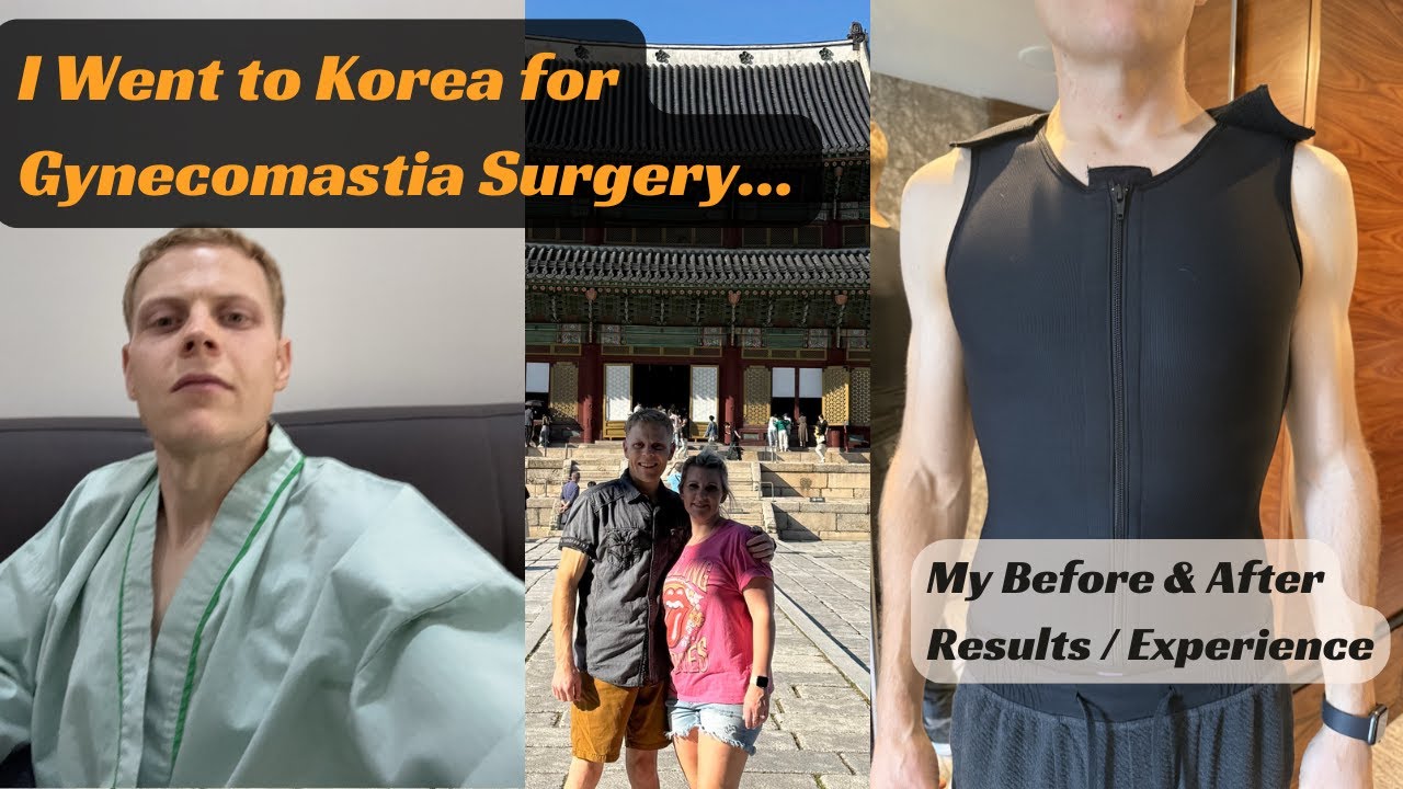 I went to Korea for Gynecomastia Surgery - My Results!