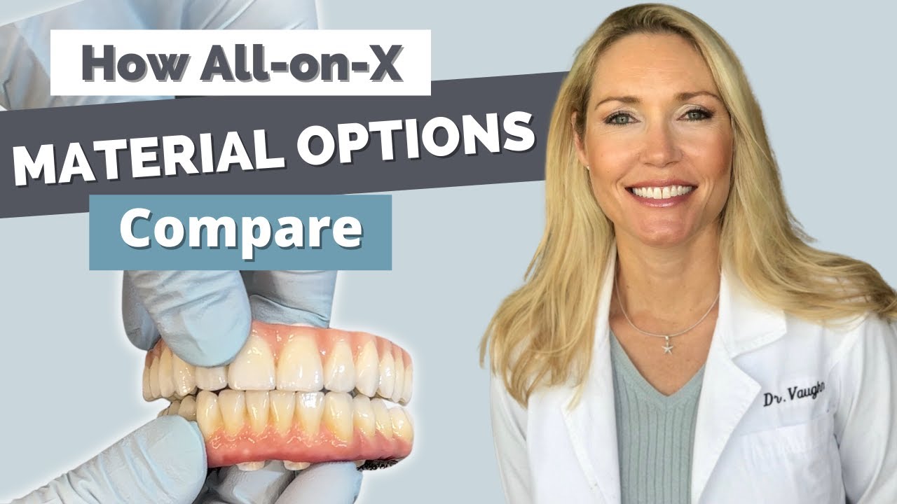 All on 4 Final Materials Comparison