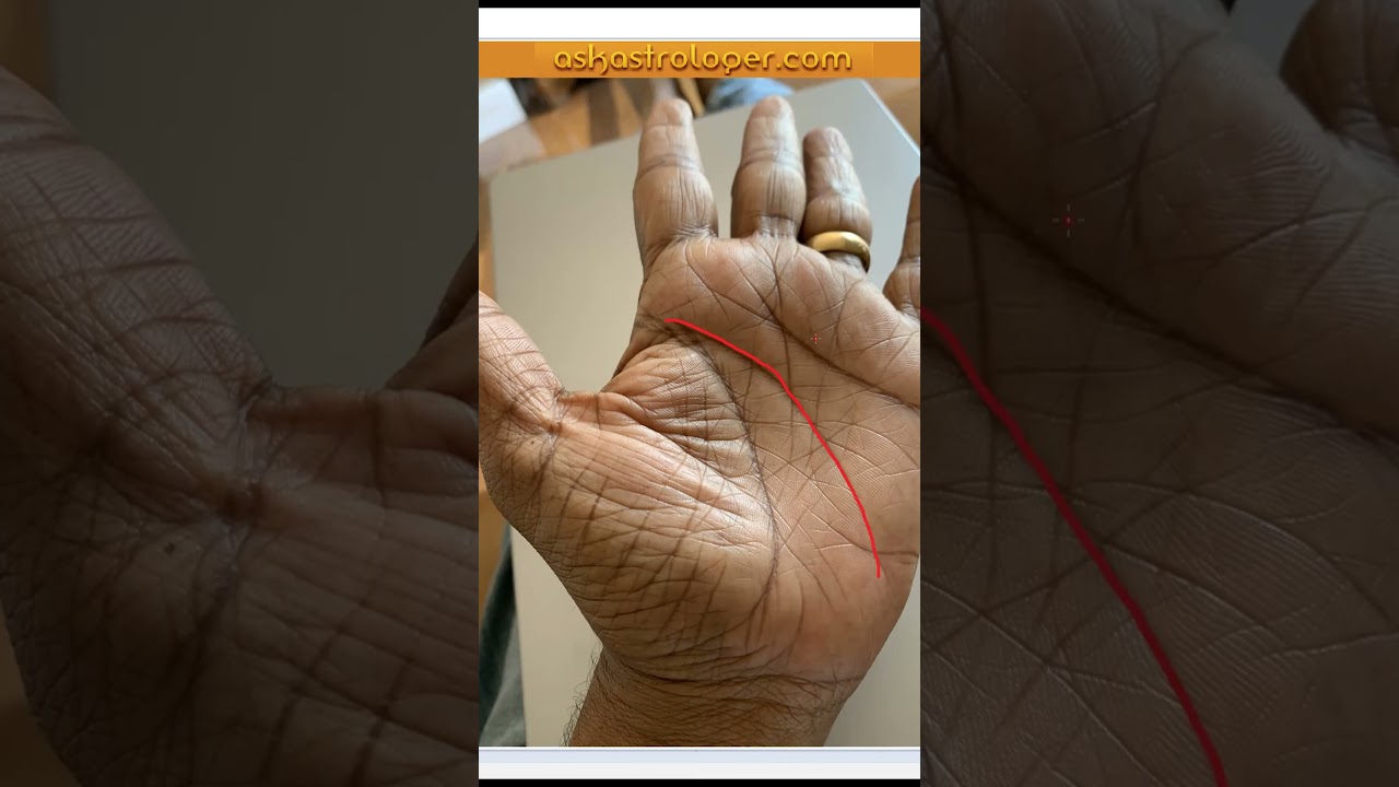 Long and curved head line in Palms