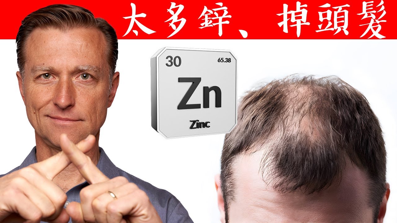 掉頭髮,是鋅太多了,生髮訣竅要多少鋅？自然療法,柏格醫生 Dr Berg