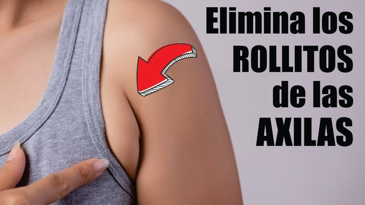 LIPO de los ROLLITOS de las AXILAS 👙 LIPOSUCCIÓN de GRASA PRE AXILAR ❤️ Dr ALBERTO CALVO QUROZ