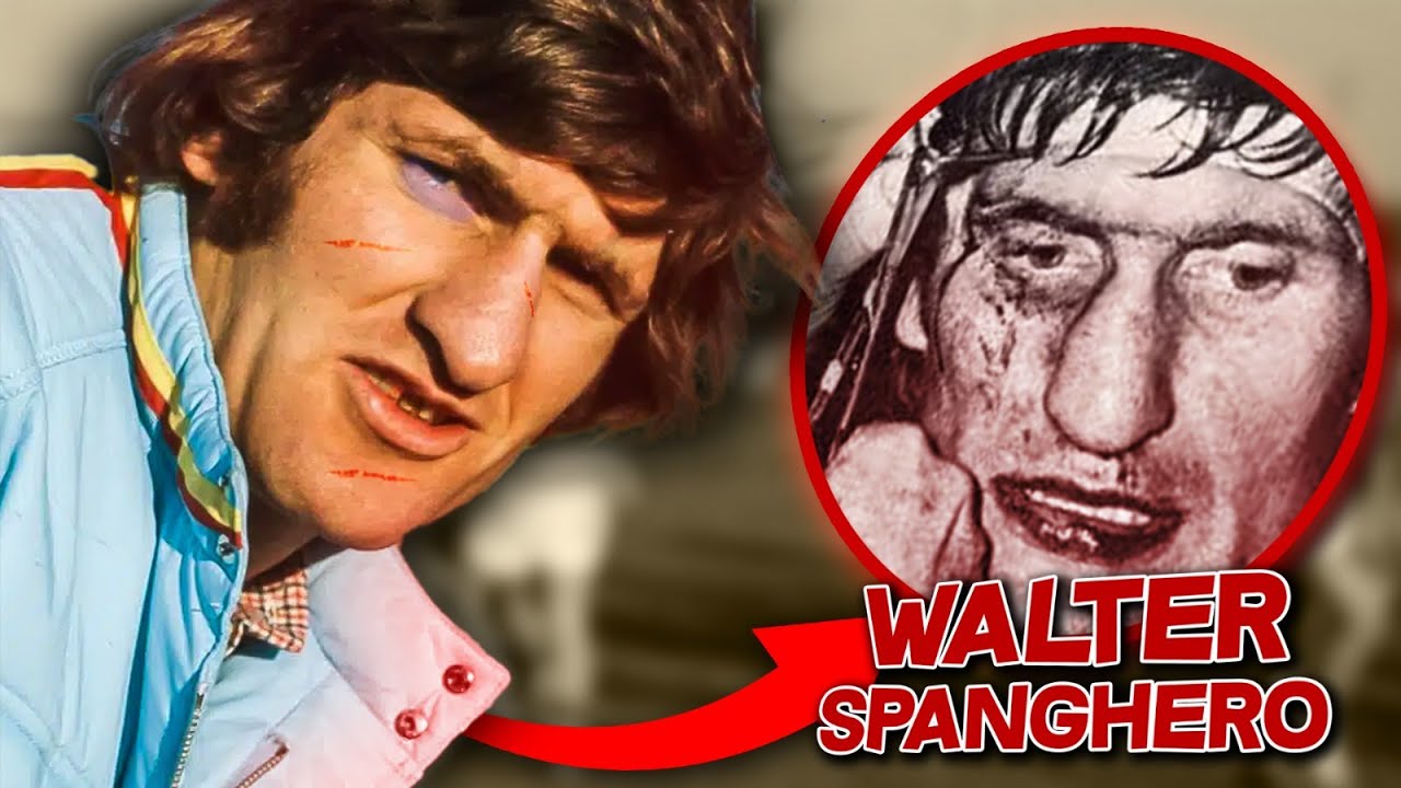 🇫🇷 *13 Le joueur le plus blessé de l’histoire du rugby — Walter Spanghero