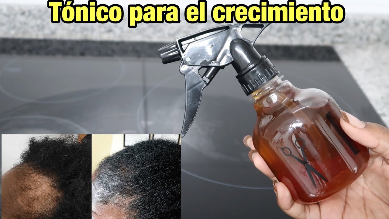 INFUSION PARA EL CRECIMIENTO DEL CABELLO || Remedios para la caida del cabello || Rihanel